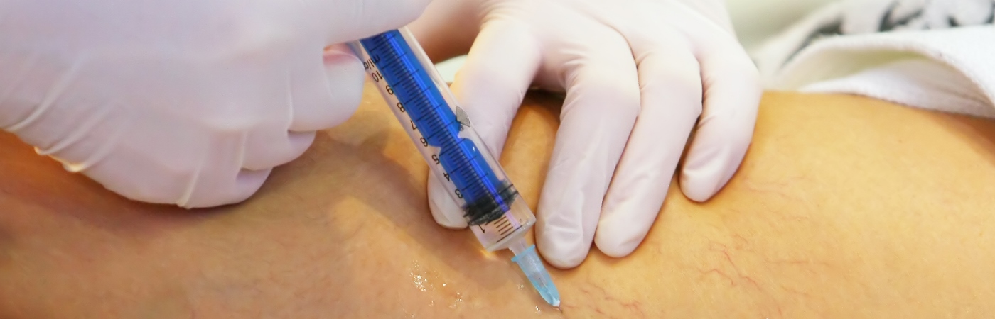 tratamentul oamenilor de varicoză inițială cum să scapi de rețetă varicoasă